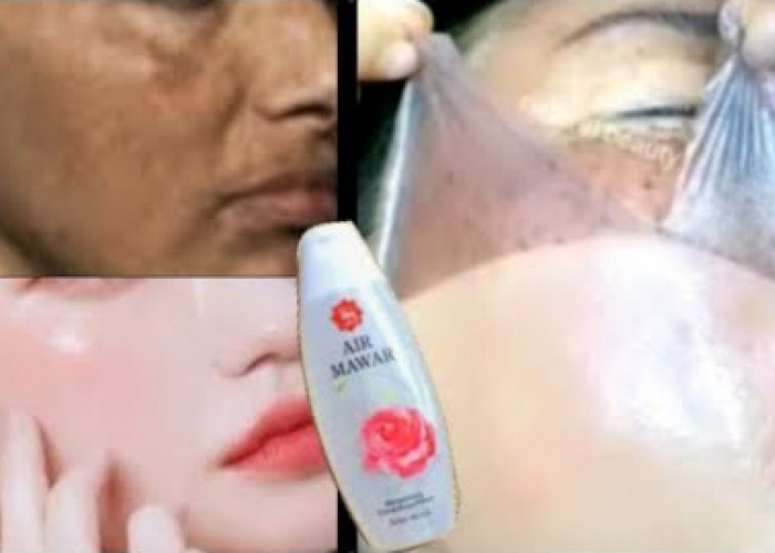 Begini Cara Pakai Air Mawar di Muka Agar Glowing dan Cerah Seketika, Cuma 3 Langkah!