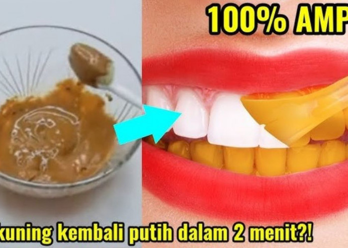 4 Daftar Bahan Alami Pemutih Gigi Kuning, Begini Cara Mudah Menggunakannya 