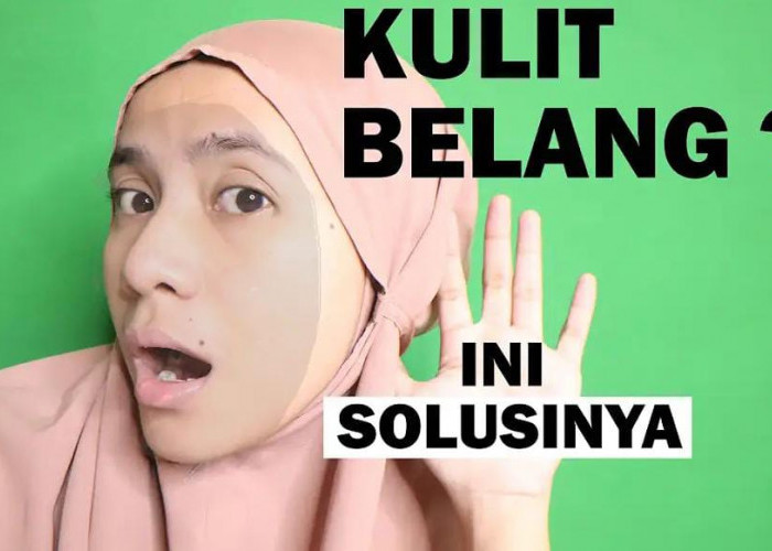 4 Cara Menghilangkan Belang di Muka Dengan Cepat Secara Alami