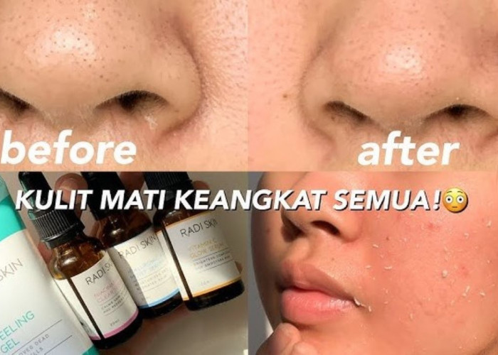 4 Merk Peeling Gel untuk Mengecilkan Pori-Pori, Angkat Sel Kulit Mati Bikin Wajah Cerah Merata