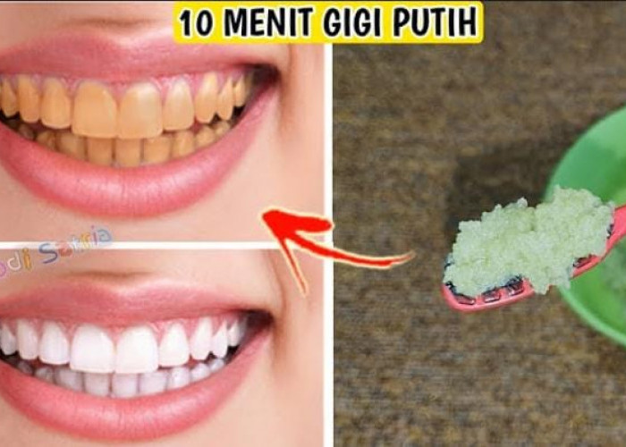 Begini Cara Memutihkan Gigi Kuning dengan 3 Jenis Buah, Bikin Gigi Bersih Bebas Noda dan Plak Gak Pakai Lama