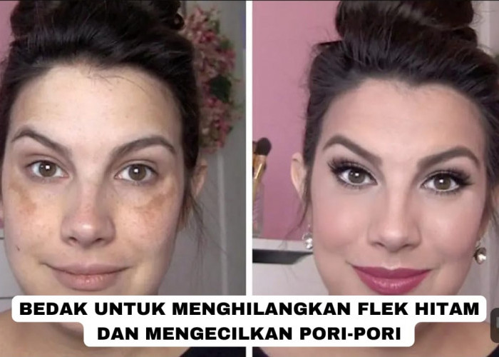 3 Bedak untuk Menghilangkan Flek Hitam dan Mengecilkan Pori-Pori Terbaik, Bikin Wajah Langsung Glowing!