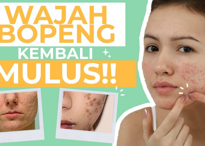 Begini 5 Cara Pakai Daun Sirih untuk Wajah Bopeng, Rahasia Glowing Tanpa Modal