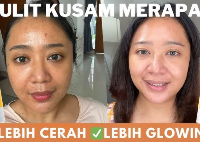 3 Sunscreen untuk Menghilangkan Flek Hitam Terbaik di Indomaret, Bikin Glowing Awet Muda Bebas Noda