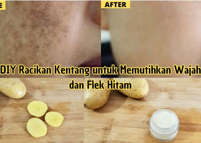 DIY Racikan Kentang untuk Memutihkan Wajah dan Flek Hitam, Rahasia Glowing dalam 5 Langkah