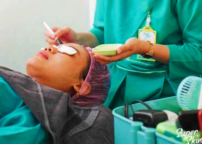 Klinik Kecantikan Superskin Hadirkan Pilihan Paket Treatment Untuk Mahasiswa