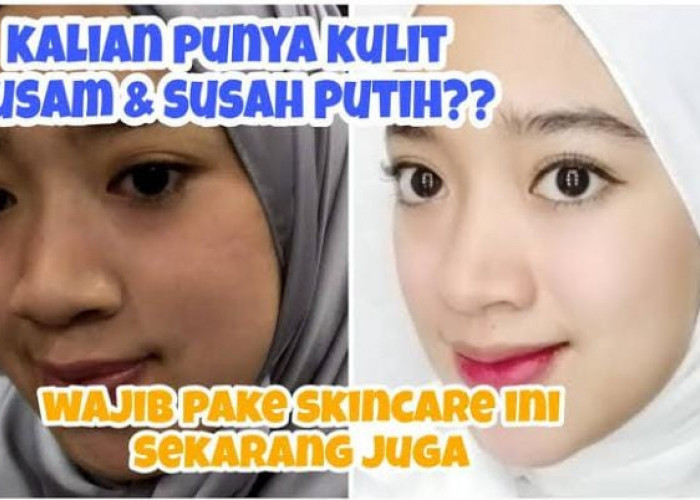 5 Produk Skincare untuk Kulit Kusam dan Gelap, Cara Simpel Punya Wajah Glowing Bebas Noda Hitam