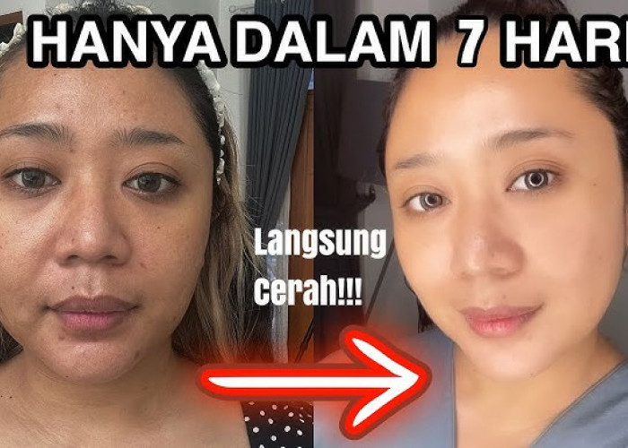 3 Cara Memutihkan Wajah dengan Bahan Alami di Dapur, Bikin Glowing Bebas Flek Hitam di Usia 40 Tahun Ke Atas