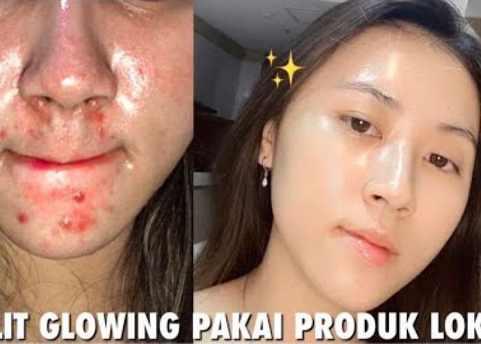 Inilah Cara Menggunakan Air Mawar yang Benar, Flek Hitam dan Kerutan Hilang Wajah Glowing Bebas Jerawat