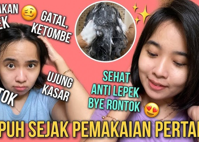 4 Shampo Anti Ketombe Paling Ampuh, Bantu Atasi Gatal hingga Kerontokan