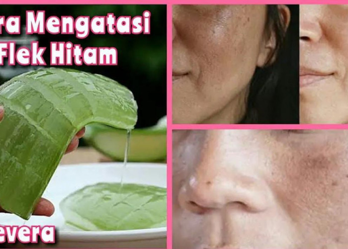 3 Cara Mengelupas Flek Hitam Dengan Lidah Buaya Agar Wajah Glowing, Cuma Pakai 2 Bahan Dapur