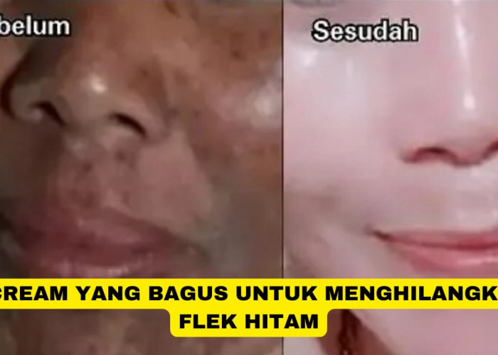 4 Cream yang Bagus untuk Menghilangkan Flek Hitam Agar Wajah Glowing, Kulit jadi Kencang Awet Muda!