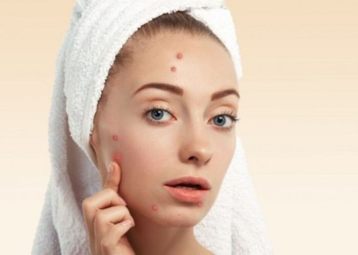 5 Skincare Emina yang Bisa Menghilangkan Bekas Jerawat, Nggak Takut Kulit Kusam Lagi