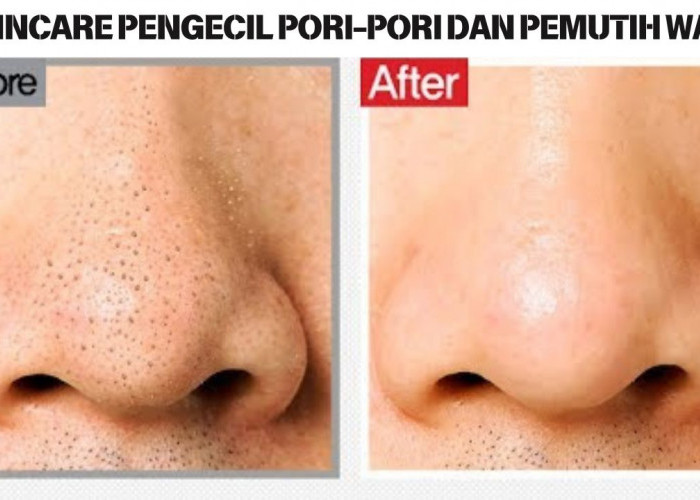 4 Skincare Pengecil Pori-Pori dan Pemutih Wajah, Cocok Dipakai Usia 40 Tahun Ke Atas Bikin Glowing Awet Muda