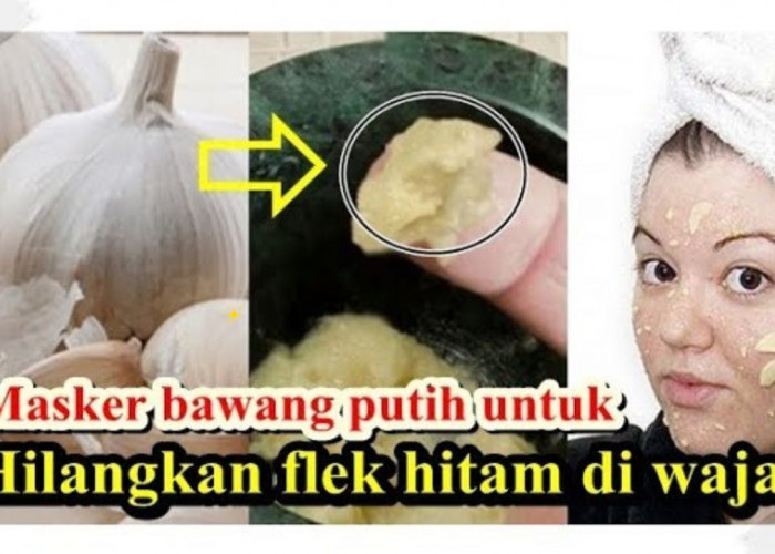 Cara Menggunakan Masker Bawang Putih untuk Menghilangkan Flek Hitam, Langsung Glowing dalam 3 Langkah!