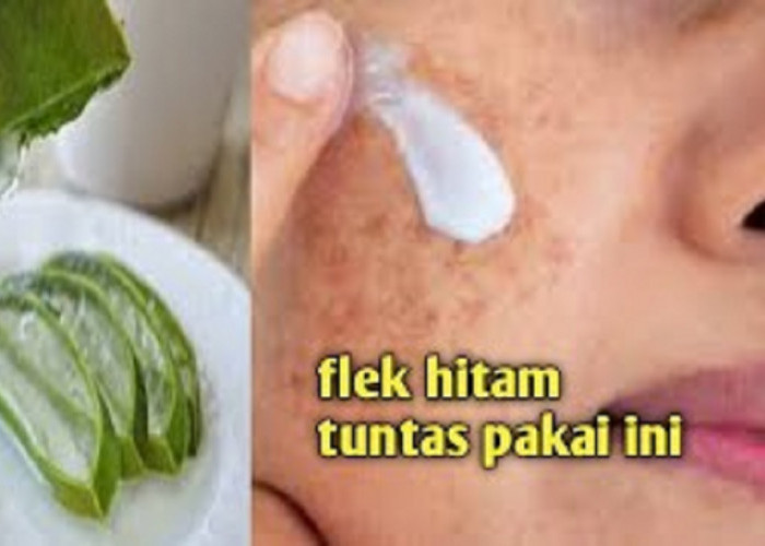 Tips Hilangkan Kerutan dan Flek Hitam dengan Lidah Buaya, Cuma 3 Cara Buat Kulit Selangkah Lebih Muda