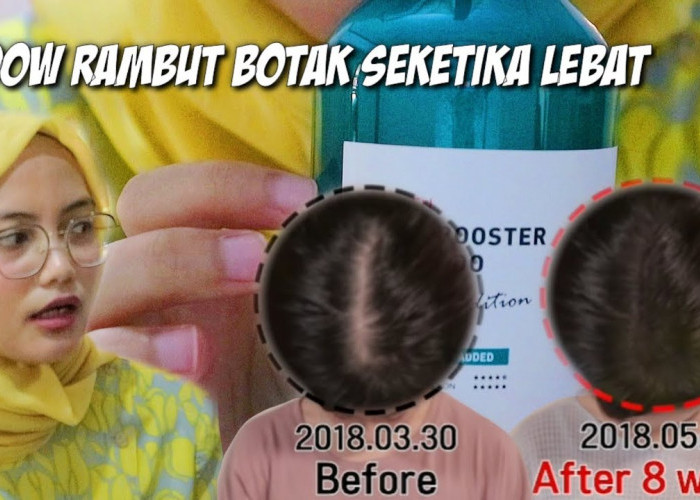 4 Shampo Penumbuh Rambut Botak Paling Ampuh, Rambut Jadi Lebat dan Sehat Modal 20 Ribuan di Indomaret