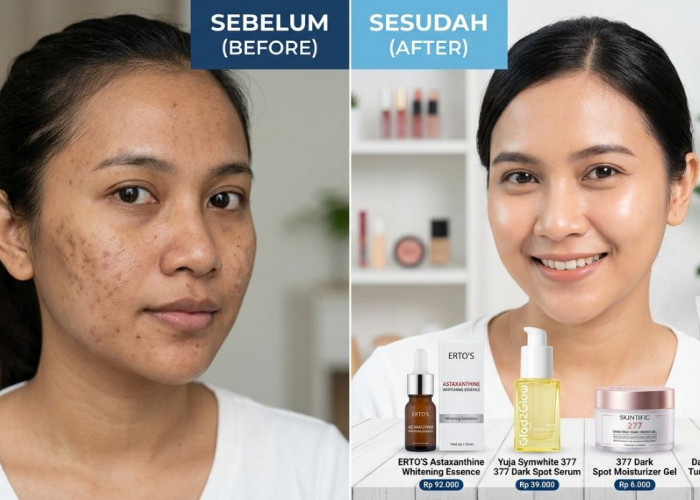 Top 4 Skincare Flek Hitam Terbaik yang Bisa Dipakai Secara Rutin Agar Kulit Glowing