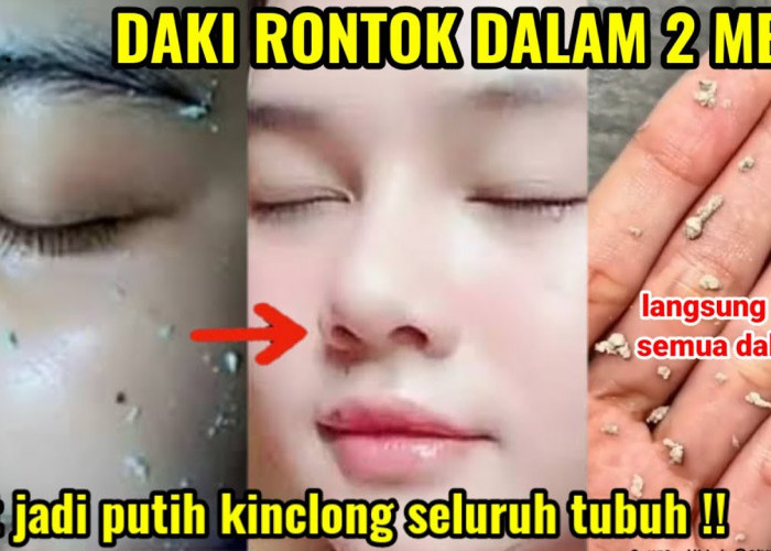 3 Cara Mengelupas Flek Hitam dengan Masker Alami, Efektif Samarkan Pori-Pori Terbuka