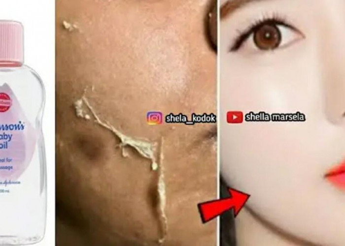 3 Cara Pakai Baby Oil untuk Mengelupas Flek Hitam Tanpa Bekas, Wajah Langsung Glowing Dalam 1 Malam