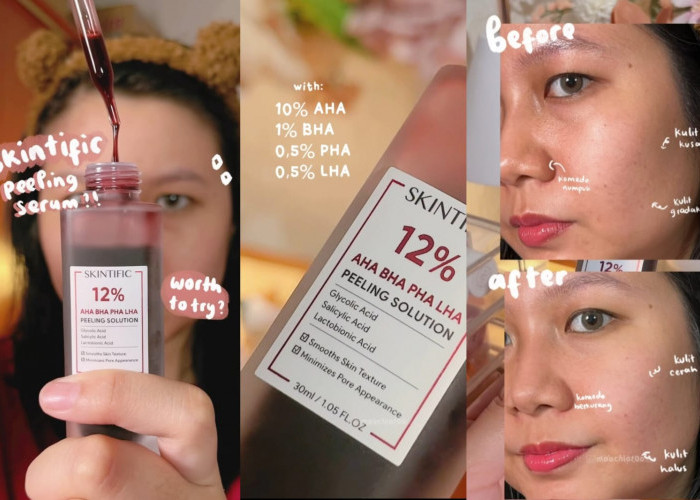 Review Jujur Serum Peeling Skintific Produk Eksfoliasi Viral Kulit Kenyal Glowing Sekali Pakai, Sebagus Itu??