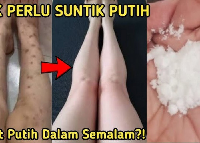 Begini Cara Membuat Lulur Pemutih Badan Permanen dari Beras, Bekas Koreng Hitam Langsung Hilang!