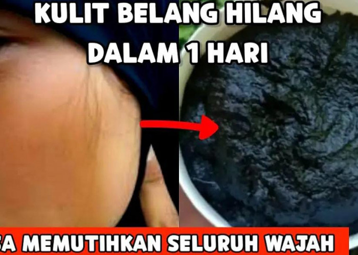 3 Cara Menghilangkan Belang di Wajah Dengan Cepat, Kulit Langsung Glowing!