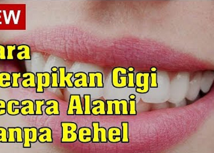 5 Cara Cepat Merapikan Gigi Tanpa Behel dalam 1 Hari, Bikin Gigi Tampil Putih Bersih Rata Gak Berantakan 