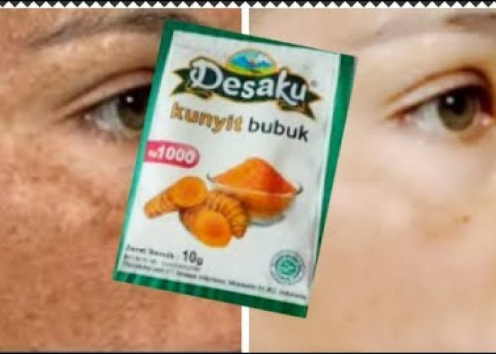 Begini Cara Bikin Wajah Kusam Jadi Glowing dengan Masker Kunyit, Cuma 3 Langkah Bikin Mulus Bebas Noda