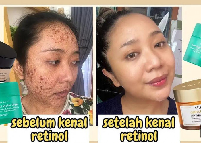 4 Skincare yang Mengandung Retinol untuk Wajah Glowing Awet Muda, Ampuh Hilangkan Flek Hitam di Wajah!