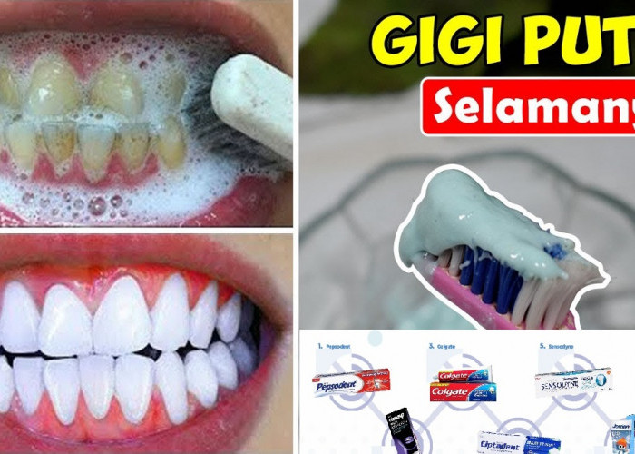 5 Merek Pasta Gigi yang Bagus untuk Memutihkan Gigi, Auto Putih Bersih Bebas Noda Plak dan Karang Membandel