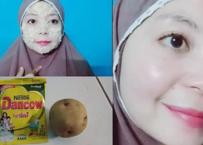 3 Cara Menghilangkan Flek Hitam dengan Kentang Agar Glowing, Bantu Kecilkan Pori-Pori