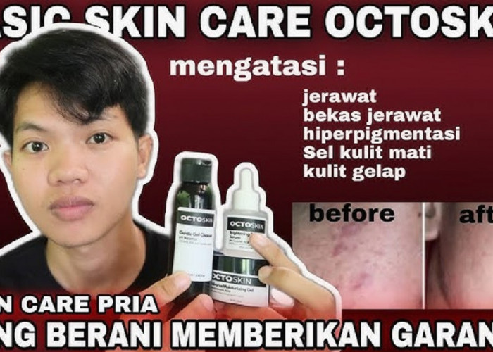 3 Rekomendasi Skincare Cowok untuk Kulit Berminyak, Mulai Rp25 Ribuan Wajah Cerah Kecilkan Pori-Pori