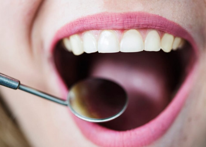6 Bahan Alami Penghilang Karang Gigi dan Pemutih Alami untuk Senyum Lebih Cerah