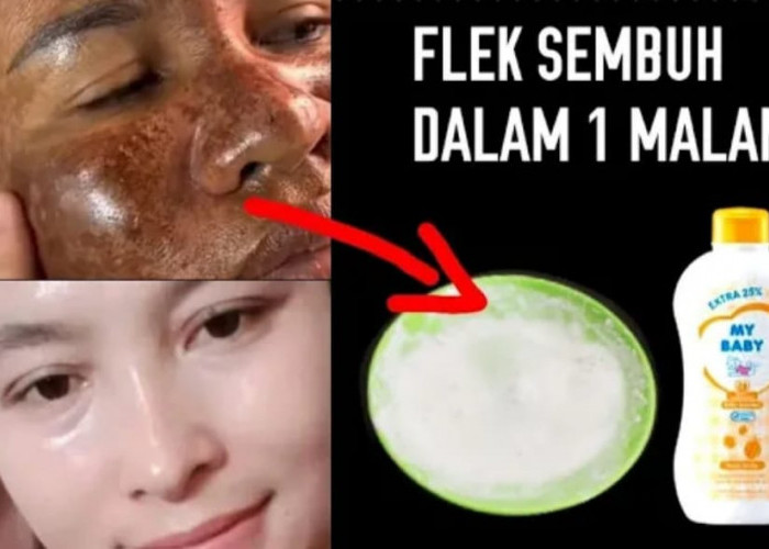 4 Cara Membuat Masker Menghilangkan Flek Hitam Secara Permanen, Wajah Langsung Mulus Bebas Noda dan Kusam