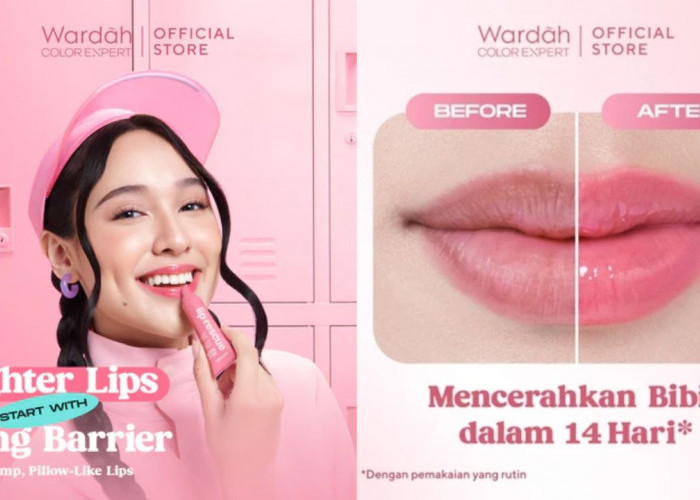 NEW LAUNCH! Review Wardah Lip Rescue Jelly Balm, Cerahkan Bibir Hitam dalam 14 Hari