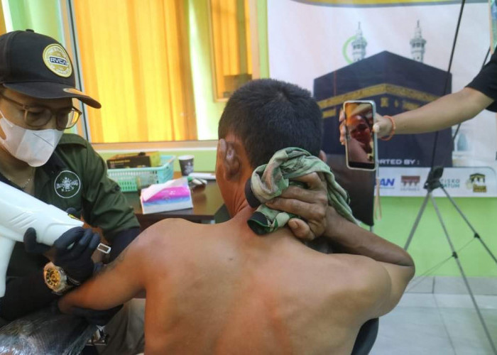 PC GP Ansor Kabupaten Pekalongan Gelar Layanan Hapus Tatto