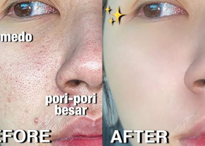 4 Serum Terbaik untuk Kulit Berminyak dan Mengecilkan Pori-Pori, Bikin Wajah Mulus dan Glowing