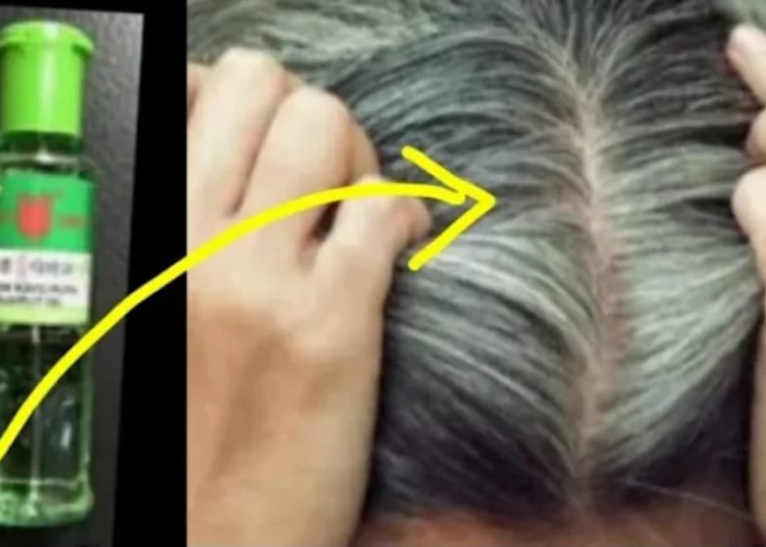 Rambut Uban Jadi Hitam Permanen Dalam Sekali Pakai! Ini 5 manfaat Minyak Kayu Putih untuk Rambut Beruban