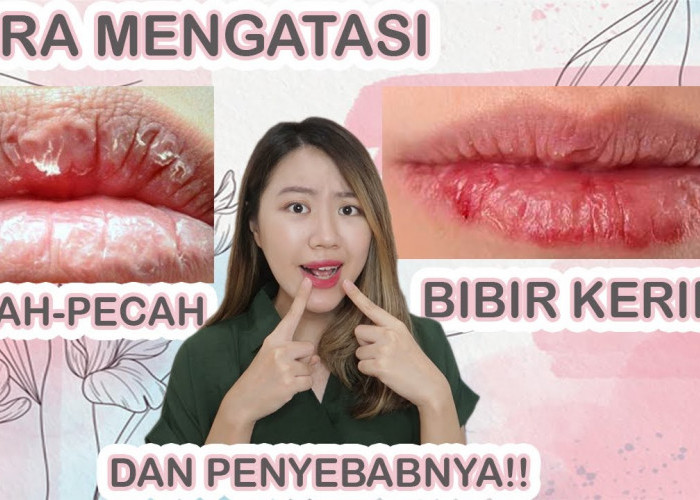 3 Cara Mengatasi Bibir Kering Saat Puasa Secara Alami, Bibir Auto Lembap dan Kenyal Sepanjang Hari!