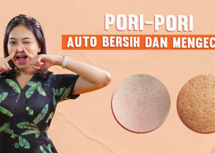 3 Moisturizer yang Bisa Mengecilkan Pori-Pori, Wajah Mulus Bebas Kilap Seharian