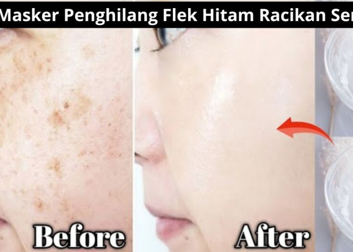 DIY Masker Penghilang Flek Hitam Racikan Sendiri, Cukup 10 Menit Ampuh Memutihkan Bikin Wajah Langsung Glowing