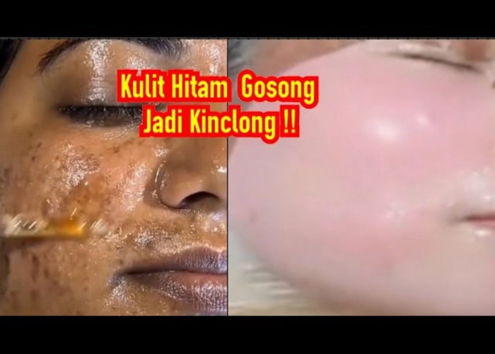 4 Cara Mengelupas Flek Hitam Dengan Masker Susu, Kulit jadi Glowing dan Putih Bebas Penuaan Dini