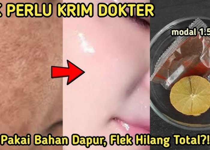 4 Bahan Dapur untuk Mengelupas Flek Hitam dalam 1 Malam, Begini Cara Meraciknya