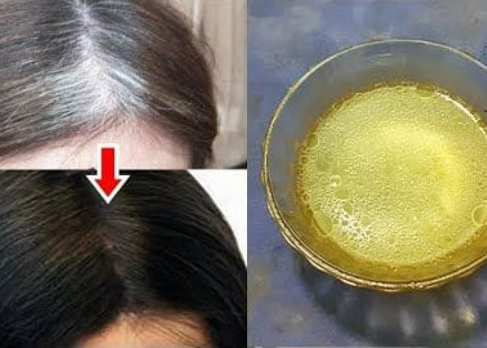 3 Cara Instan Menghilangkan Uban dengan Cuka Apel yang Benar, Tips Bebas Rambut Putih Tanpa Efek Samping