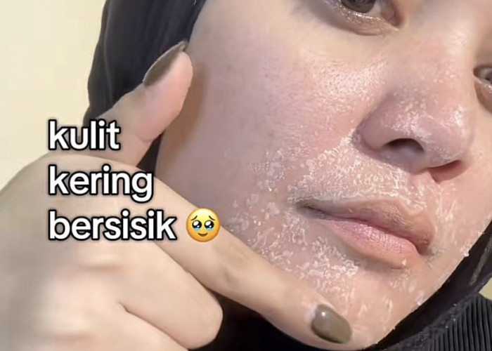 Wajah Kering Saat Puasa Ramadan?Ini 5  Cara Menjaga Kelembapan Kulit Sepanjang Hari