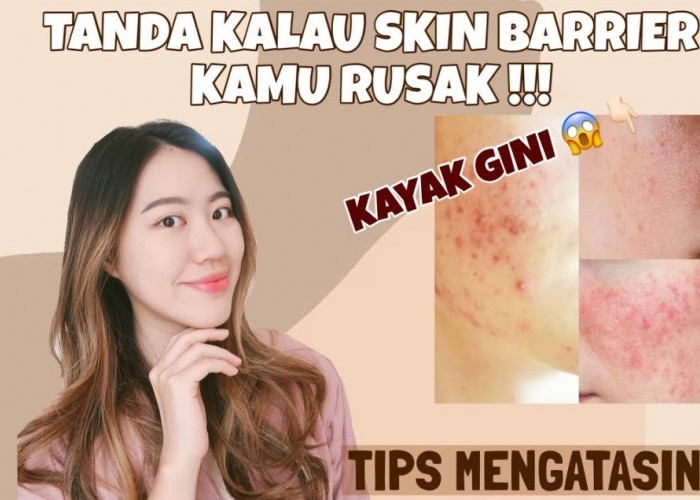 Ternyata, Begini 3 Tanda Skin Barrier Kamu Rusak Sekaligus Tips Mengatasinya