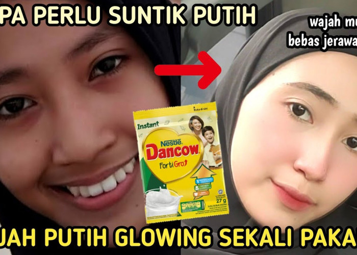 DIY Masker Susu Dancow untuk Mengelupas Flek Hitam Menahun, Bikin Glowing dalam 1 Malam