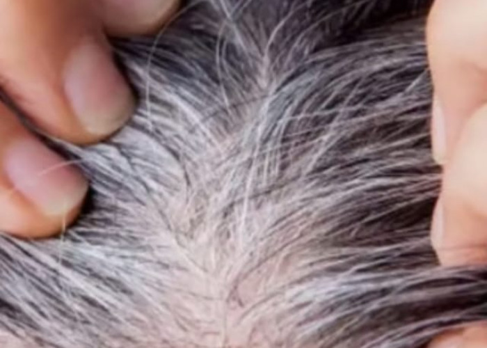 3 Obat Uban Alami yang Ampuh Menghitamkan Rambut, Hasil Permanen Tanpa Dicabut atau Disemir, Ga Pakai Lama