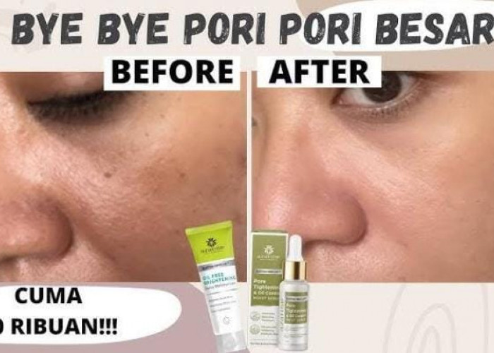 6 Serum untuk Mengecilkan Pori-Pori dan Kulit Berminyak, Efektif Mencerahkan Bikin Glowing Merata Awet Muda